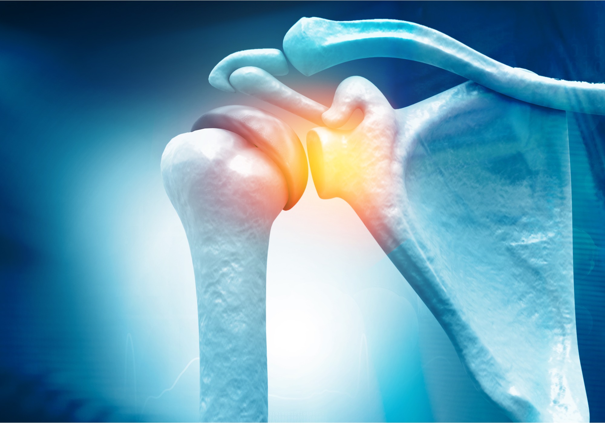 Treatments for Rotator Cuff Injury